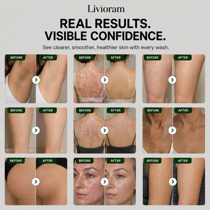 Livioram™ Face & Body Dark Spot Soap