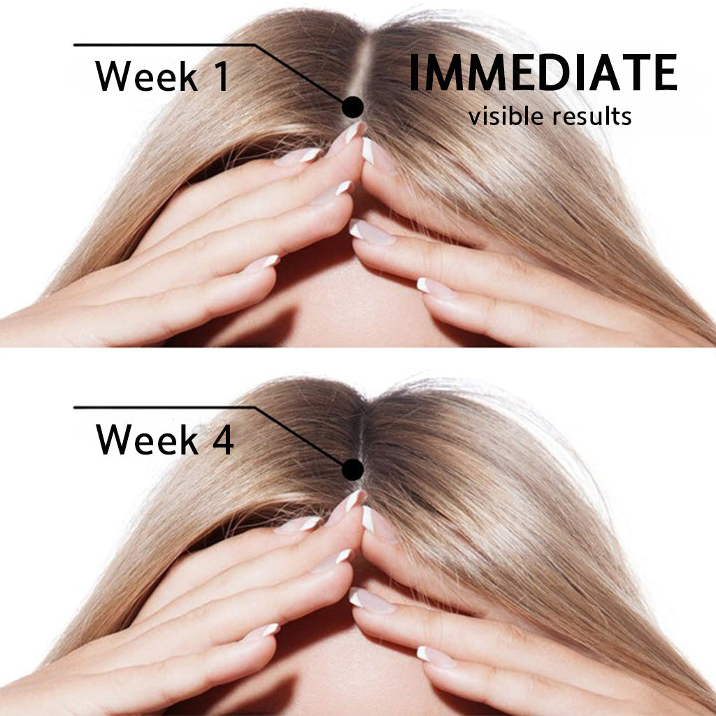 👨‍⚕️👨‍⚕️Official US Store | 🔥Livioram® Highly Effective Biotin & Rosemary Hair Growth Serum — Visibly fills thinning areas & receding hairlines (🔥 Limited-Time Offer, ⏳ Last 30 Minutes)