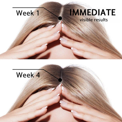 👨‍⚕️👨‍⚕️Official US Store | 🔥Livioram® Highly Effective Biotin & Rosemary Hair Growth Serum — Visibly fills thinning areas & receding hairlines (🔥 Limited-Time Offer, ⏳ Last 30 Minutes)
